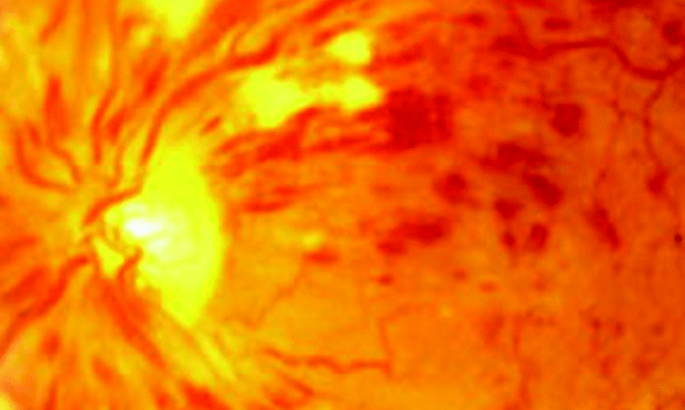 Doc! I can not see, he suddenly cried!