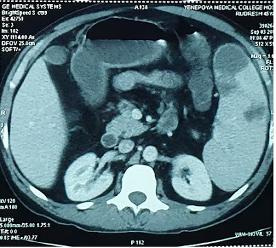 A careful examination clinched the diagnosis